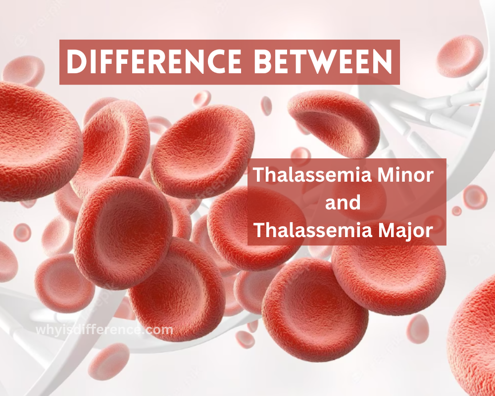 Difference Between Thalassemia Minor and Thalassemia Major