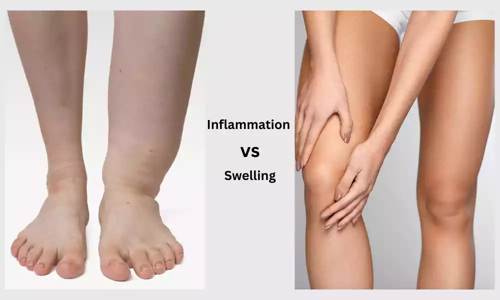 Inflammation and Swelling
