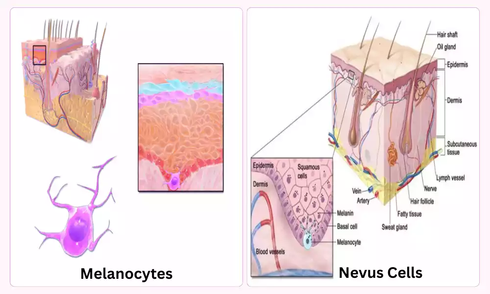 Melanocytes and Nevus Cells