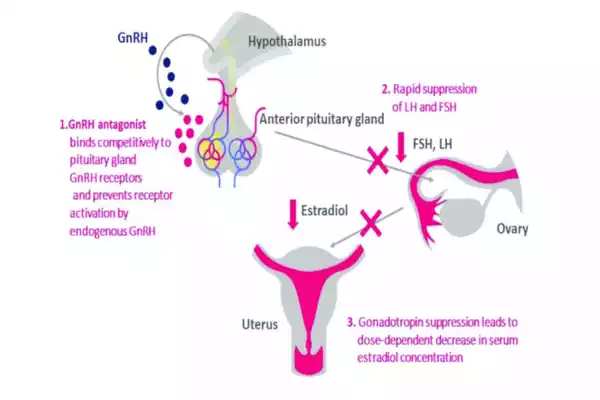 GnRH Antagonists