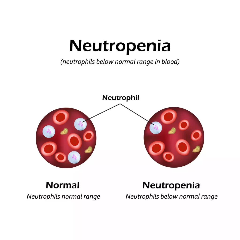 neutropenia